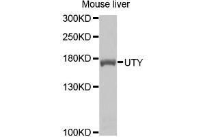 Western blot analysis of extracts of mouse liver cells, using UTY antibody. (UTY Antikörper)