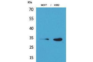 Western Blotting (WB) image for anti-Cyclin-Dependent Kinase 4 (CDK4) (N-Term) antibody (ABIN3187734)