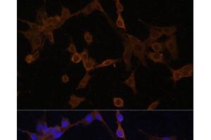 Immunofluorescence analysis of NIH/3T3 cells using BID Polyclonal Antibody at dilution of 1:100. (BID Antikörper)