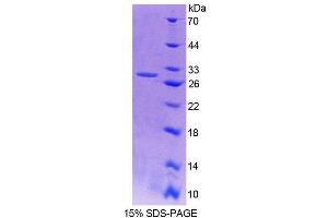 SDS-PAGE (SDS) image for Nuclear Receptor Subfamily 2, Group C, Member 2 (NR2C2) (AA 371-596) protein (His tag) (ABIN6239523)