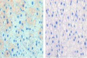 Left image is paraformaldehyde-fixed and paraffin-embedded cow lactating with CPT1A Pab (ABIN389101 and ABIN2839291) , which was peroxidase-conjugated to the secondary antibody, followed by AEC staining, right image is contrast, did not add the antibody.