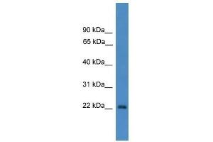 OTUB2 antibody used at 0.