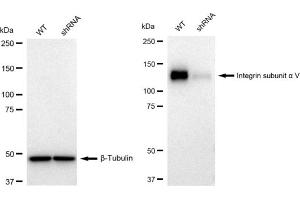 Western blotting analysis using Integrin subunit alpha V antibody (ABIN7800944).