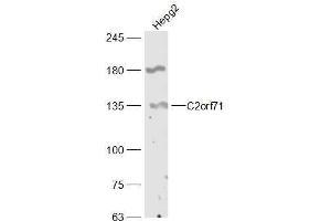 HepG2 lysates probed with C2orf71 Polyclonal Antibody, Unconjugated  at 1:300 dilution and 4˚C overnight incubation. (C2orf71 Antikörper  (AA 701-800))