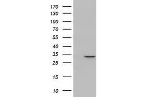 HEK293T cells were transfected with the pCMV6-ENTRY control (Left lane) or pCMV6-ENTRY PBLD (Right lane) cDNA for 48 hrs and lysed. (PBLD1 Antikörper)