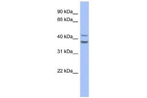 SERPINB2 antibody used at 1 ug/ml to detect target protein. (SERPINB2 Antikörper)