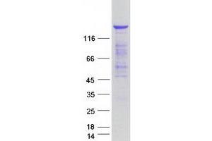 Western Blotting (WB) image for TBC1 (Tre-2/USP6, BUB2, Cdc16) Domain Family, Member 1 (TBC1D1) protein (Myc-DYKDDDDK Tag) (ABIN2733255)