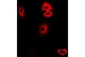 Immunofluorescent analysis of HADHA staining in U2OS cells. (HADHA Antikörper)