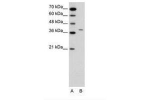 Image no. 1 for anti-Receptor-Associated Protein of The Synapse (RAPSN) (N-Term) antibody (ABIN6736649) (RAPSN Antikörper  (N-Term))