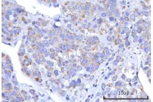 IHC analysis of C18orf22/RBFA using anti-C18orf22/RBFA antibody (ABIN7600106). (RBFA Antikörper  (AA 15-319))