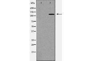 Western blot analysis of TYK2 expression in 293 cell,The lane on the left is treated with the antigen-specific peptide. (TYK2 Antikörper  (C-Term))
