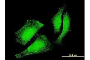 Immunofluorescence of monoclonal antibody to FOXO3 on HeLa cell. (FOXO3 Antikörper  (AA 361-460))