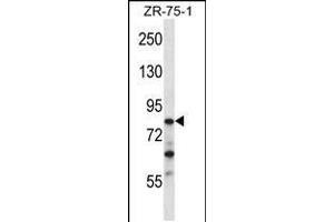 Western blot analysis in ZR-75-1 cell line lysates (35ug/lane). (CNOT3 Antikörper  (N-Term))
