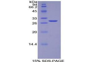 SDS-PAGE analysis of Human TOR1AIP2 Protein. (TOR1AIP2 Protein)