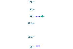 B4GALT2 Protein (AA 1-306) (GST tag)