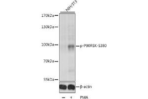 Western blot analysis of extracts of various cell lines, using Phospho-p90Rsk/RSK1/RPS6K-S380 antibody (ABIN6135275, ABIN6136172, ABIN6136173 and ABIN6225586) at 1:1000 dilution. (RPS6KA1 Antikörper  (pSer380))