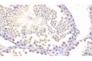 Detection of INHa in Mouse Testis Tissue using Polyclonal Antibody to Inhibin Alpha (INHa) (Inhibin alpha Antikörper  (AA 240-366))