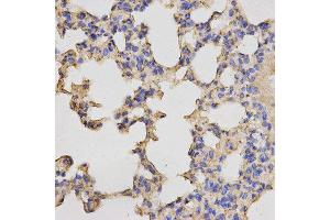 Immunohistochemistry (IHC) image for anti-Protein Kinase, CAMP Dependent, Catalytic, beta (PRKACB) antibody (ABIN1876512) (PRKACB Antikörper)