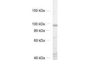 dilution: 1 : 500, sample: rat brain homogenate (CASK Antikörper  (AA 1-337, AA 318-415))
