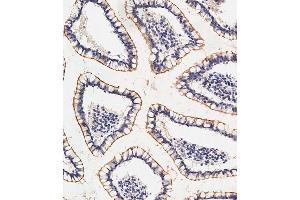Immunohistochemical analysis of paraffin-embedded human small intestine tissue using (ABIN656646 and ABIN2845888) performed on the Leica® BOND RXm.