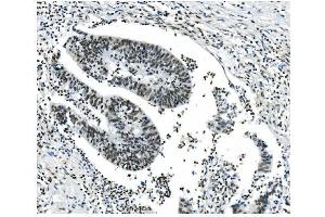 IHC analysis of NRF1 using anti-NRF1 antibody (ABIN7600874). (NRF1 Antikörper  (AA 246-503))