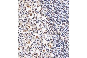 (ABIN6244013 and ABIN6578740) staining TAF4 in human tonsil tissue sections by Immunohistochemistry (IHC-P - paraformaldehyde-fixed, paraffin-embedded sections).