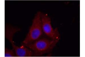 Image no. 1 for anti-Growth Associated Protein 43 (GAP43) (pSer41) antibody (ABIN401573) (GAP43 Antikörper  (pSer41))