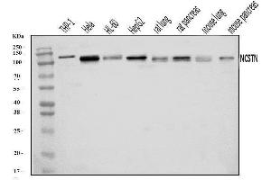 Western blot analysis of Nicastrin/NCSTN using anti-Nicastrin/NCSTN antibody (ABIN7601402).