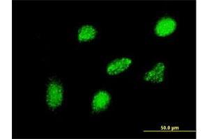 Immunofluorescence of monoclonal antibody to HEYL on HeLa cell. (HEYL Antikörper  (AA 221-327))