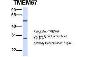 Host:  Rabbit  Target Name:  TMEM57  Sample Type:  Human Adult Placenta  Antibody Dilution:  1. (TMEM57 Antikörper  (N-Term))