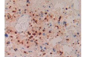 Used in DAB staining on fromalin fixed paraffin- embedded liver tissue (Azurocidin Antikörper  (AA 23-247))