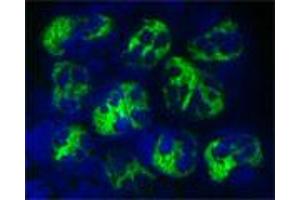 Staining of a cytospin preparation of peripheral blood mononuclear cells isolated from buffycoat. (Cathelicidin Antikörper)