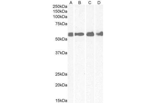 CRHR1 antibody  (AA 107-117)