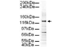 Western blot using AP3D1 polyclonal antibody  shows detection of a 130 KDa band corresponding to Human AP3D1 in a HeLa whole cell lysate. (AP3D1 Antikörper  (AA 686-698))