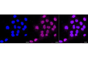 anti-Casein Kinase 2 alpha 1 (CSNK2A1) antibody