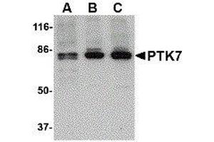 Western Blotting (WB) image for anti-PTK7 Protein tyrosine Kinase 7 (PTK7) (N-Term) antibody (ABIN2476280) (PTK7 Antikörper  (N-Term))