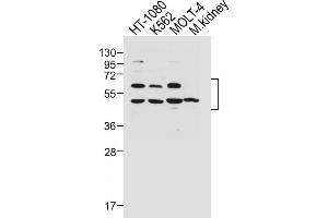 All lanes : Anti-WT1 Antibody (Center ) at 1:1000 dilution Lane 1: HT-1080 whole cell lysate Lane 2: K562 whole cell lysate Lane 3: MOLT-4 whole cell lysate Lane 4: Mouse kidney lysate Lysates/proteins at 20 μg per lane. (WT1 Antikörper  (AA 346-375))