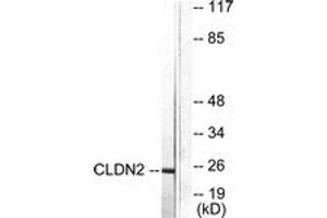 Western blot analysis of extracts from NIH-3T3 cells, using Claudin 2 Antibody. (Claudin 2 Antikörper  (AA 181-230))