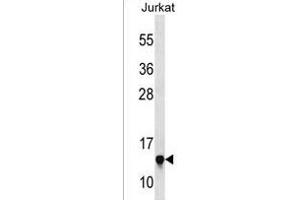 RPS23 Antibody (N-term) (ABIN1538877 and ABIN2850072) western blot analysis in Jurkat cell line lysates (35 μg/lane). (RPS23 Antikörper  (N-Term))