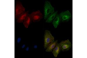 ABIN6261372 and ABIN6279351 staining  cells by IF/ICC. (Desmoglein 3 Antikörper  (C-Term))