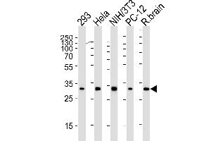 Western blot analysis of lysates from 293, Hela, mouse NIH/3T3, rat PC-12 cell line and rat brain tissue lysate(from left to right), using RPS6 Antibody (N-term) (ABIN6242615 and ABIN6577071). (RPS6 Antikörper)