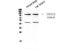 Western Blotting (WB) image for anti-Nuclear Receptor Subfamily 3, Group C, Member 2 (NR3C2) (AA 950-984), (C-Term) antibody (ABIN3043575)