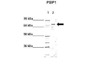 WB Suggested Anti-PSIP1 Antibody    Positive Control:  Lane 1: 5ug mouse brain cytoplasm Lane 2: 5ug mouse brain nucleus   Primary Antibody Dilution :   1:1000  Secondary Antibody :  Anti rabbit - IR-dye  Secondry Antibody Dilution :   1:10,000   Submitted by:  Anonymous (PSIP1 Antikörper  (Middle Region))
