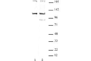 TRIM37 antibody (pAb) tested by Western blot. (TRIM37 Antikörper  (C-Term))
