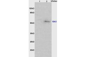 Lane 1: mouse intestine lysates Lane 2: mouse lung lysates probed with Anti phospho-MAPKAPK5(Ser93) Polyclonal Antibody, Unconjugated (ABIN710561) at 1:200 in 4 °C. (MAPKAP Kinase 5 Antikörper  (pSer93))