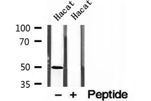 Western blot analysis of extracts of Hacat cells, using AP1M1 antibody. (AP1M1 Antikörper  (Internal Region))