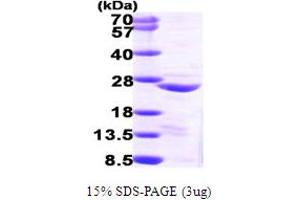 SDS-PAGE (SDS) image for Copper Metabolism (Murr1) Domain Containing 1 (COMMD1) (AA 1-190) protein (His tag) (ABIN667798)