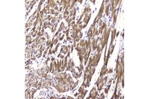 Immunohistochemistry (IHC) image for anti-Fatty Acid Binding Protein 3, Muscle and Heart (FABP3) (AA 2-133) antibody (ABIN6654044)