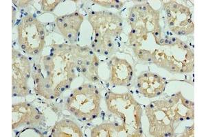 Immunohistochemistry (IHC) image for anti-Defective in Cullin Neddylation 1, Domain Containing 1 (DCUN1D1) (AA 1-259) antibody (ABIN7149509)
