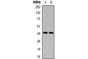 Western blot analysis of EDG5 expression in Hela (A), A10 (B) whole cell lysates. (S1PR2 Antikörper  (C-Term))
